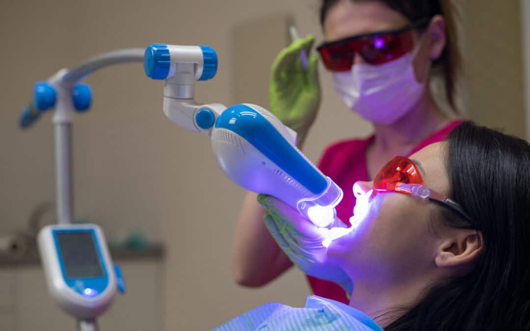 Do You Brush Your Teeth After Whitening Gel? A Toronto Dentist Explains